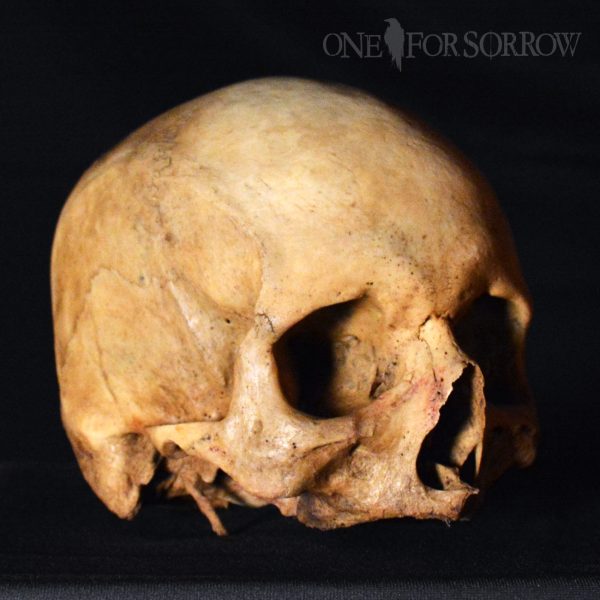 Human Skull - 14SRW1