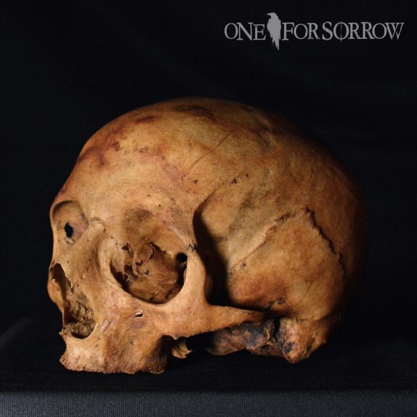 Human Skull - 14SRW2