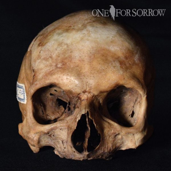 Human Skull - 14SRW3