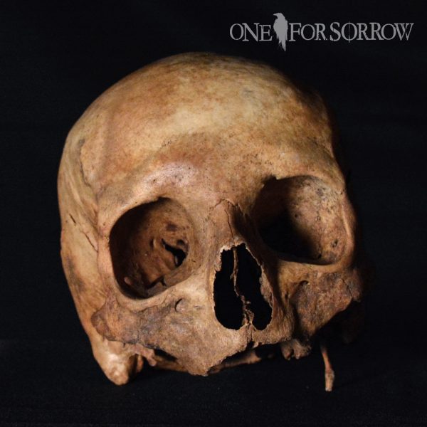 Human Skull - 14SRW4