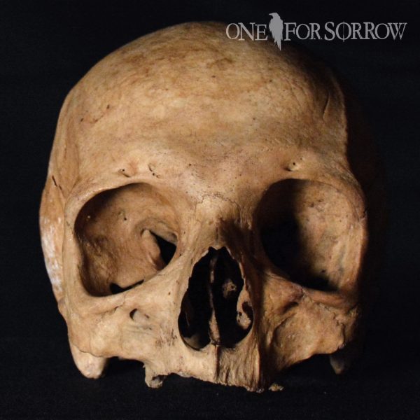 Human Skull - 14SRW5