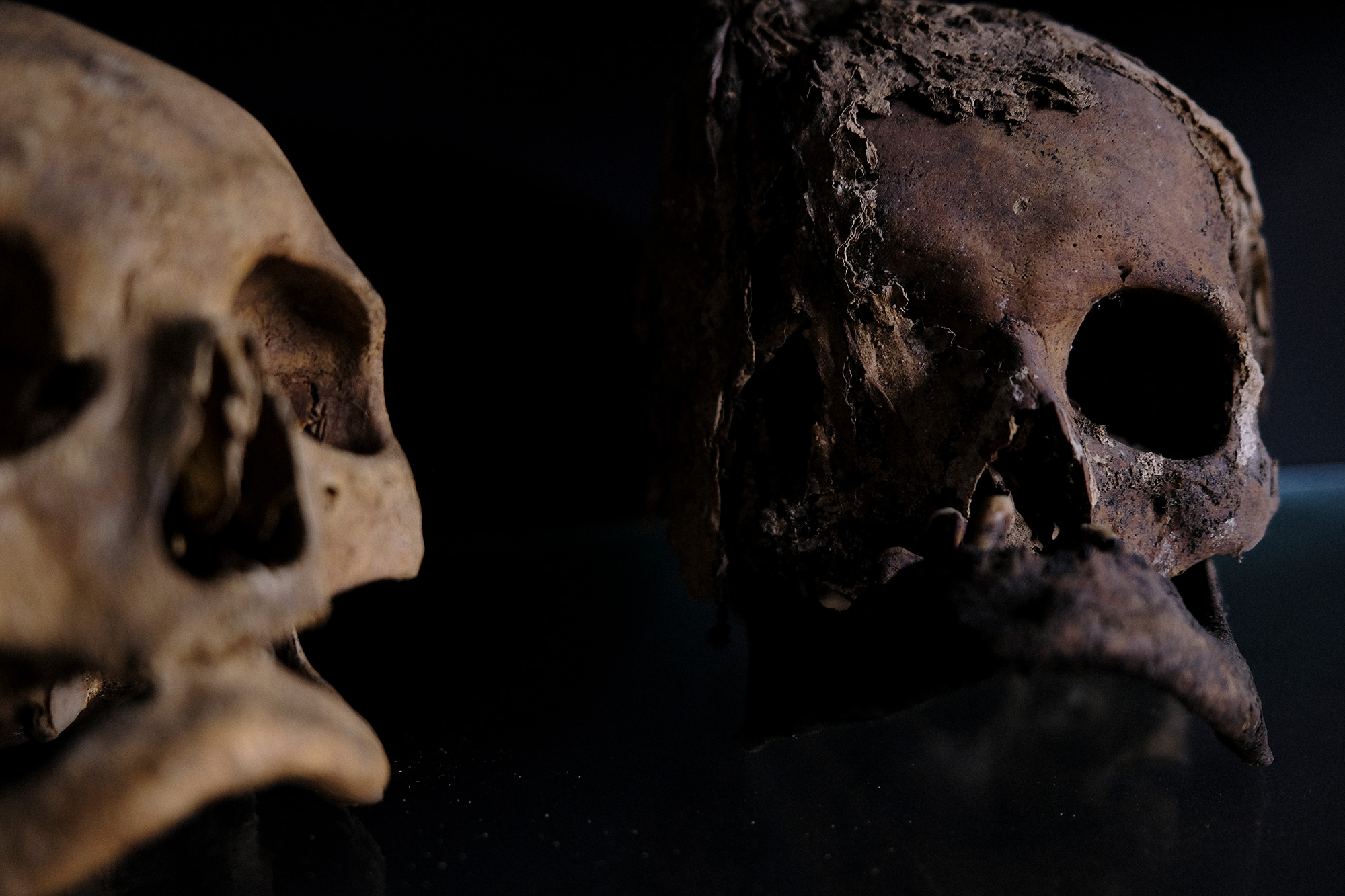 image of two human skulls