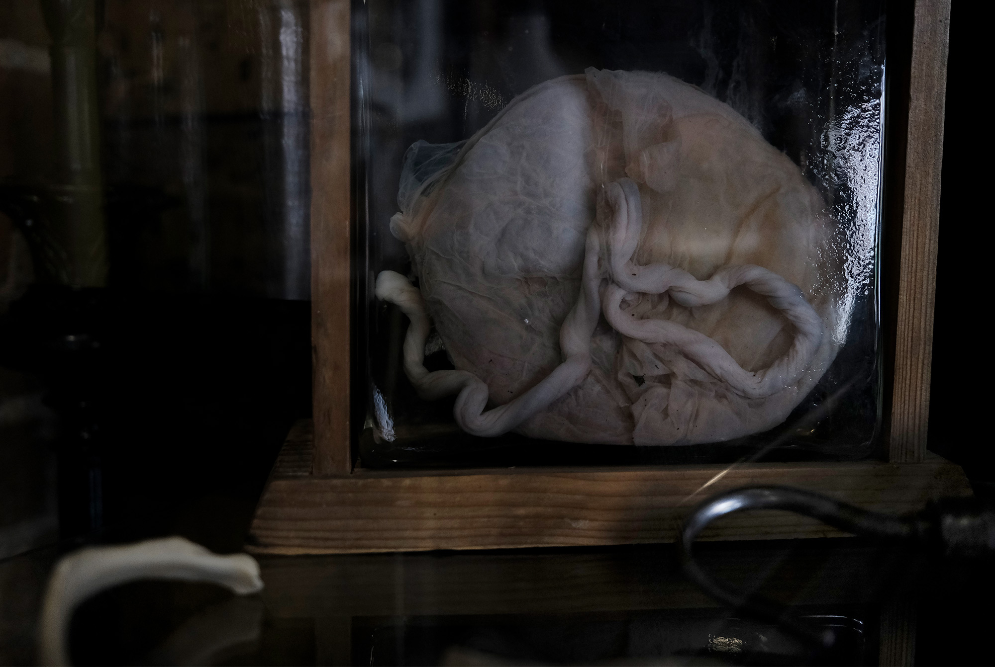 image of a medically preserved placenta